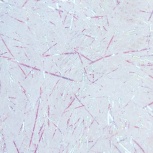 オーロラパッキン